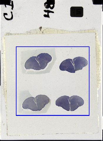 Media type: image; Special Collections 3298   shows specimen_part histological serial section;